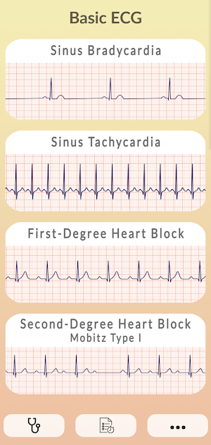 ECG Guide - Master Electrocardiogram Reading Screenshot 0