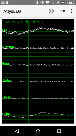 AttysEEG Screenshot 1