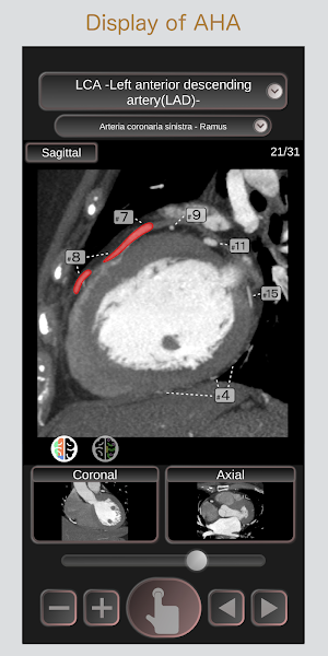 CT Passport Heart / sectional anatomy / MRI Screenshot 1
