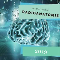 radio-anatomie"scanner cérébral"