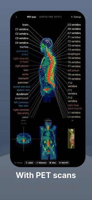 RadioAnatomy Screenshot 1