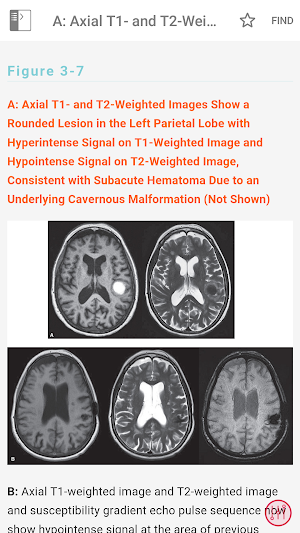 CURRENT Diagnosis & Treatment Neurology Screenshot 3