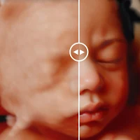 Ultrasound Baby Real Pregnancy