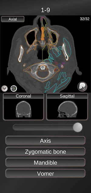 CT PassQuiz Head/Brain / sectional anatomy / MRI Screenshot 3