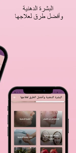 البشرة الدهنية وطرق لعلاجها Screenshot 1