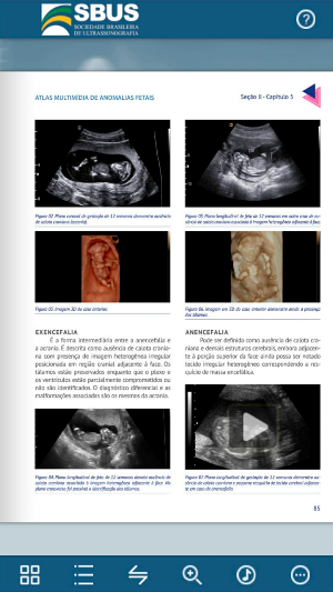 Atlas Multimídia de Anomalias Screenshot 2