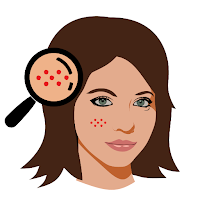 Acne Removal Tips Natural
