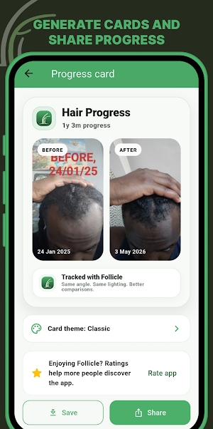 Follicle - Hair Growth Tracker Screenshot 3