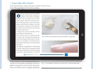 Microsurgical Endodontics Screenshot 1