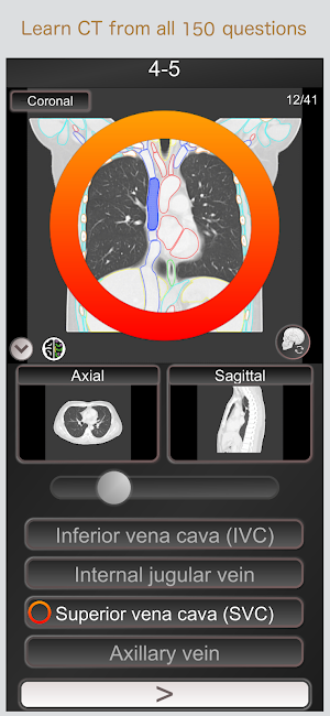 CT PassQuiz Chest / sectional anatomy / MRI Screenshot 0
