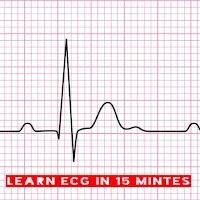 Learn ECG In 15 minutes