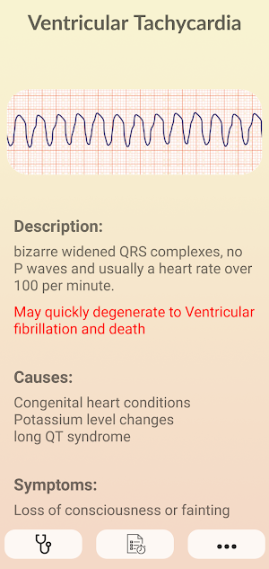 ECG Guide - Master Electrocardiogram Reading Screenshot 2