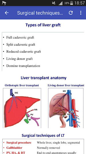 Doppler in Liver Transplant Screenshot 0