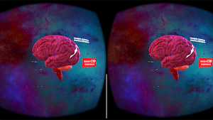 Abbott MiReality App Screenshot 0