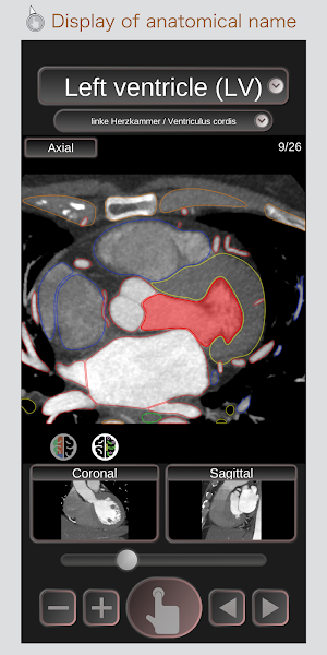 CT Passport Heart / sectional anatomy / MRI Screenshot 0