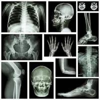 X RAY Interpretation - cases