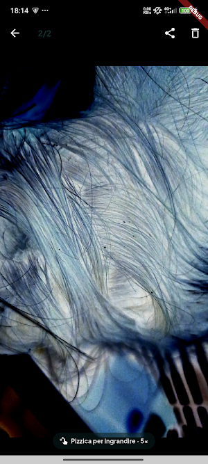 Lice Detector: Lice & Nits Screenshot 2