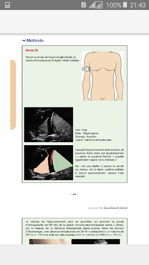 Guide d’Échographie Screenshot 3
