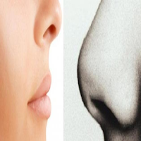 طرق تصغير الأنف