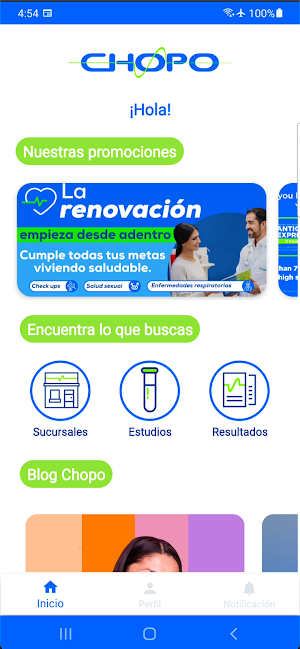 Chopo Mobile Screenshot 0