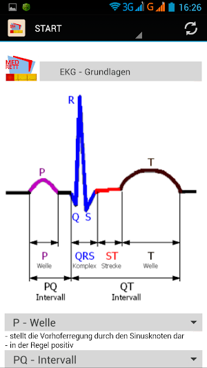 EKG-Monitoring Screenshot 1