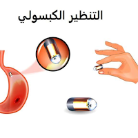 التنظير الكبسولي