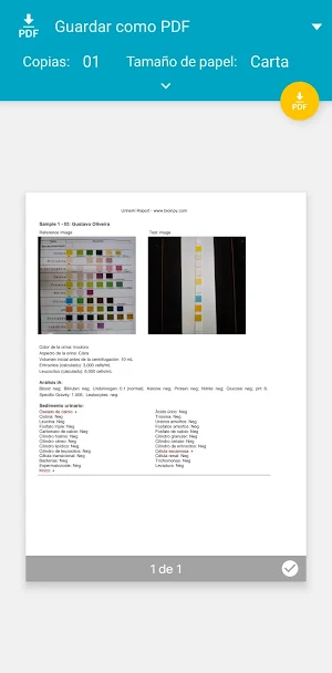 Urine AI Strip reader Screenshot 2