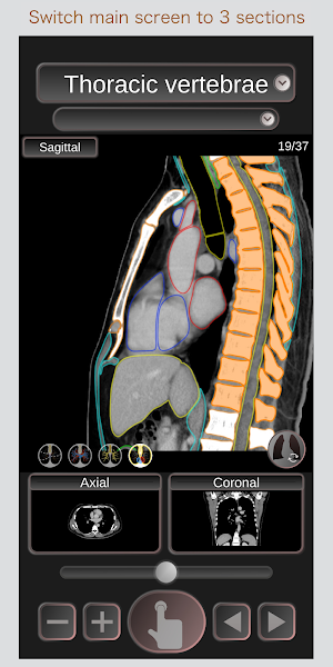 CT Passport Chest / sectional anatomy / MRI Screenshot 3