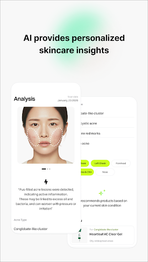 Acnecare AI Screenshot 1