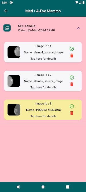Med*A-Eye Mammo Screenshot 3