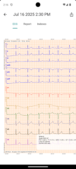 Ecg4me Doctor Screenshot 3