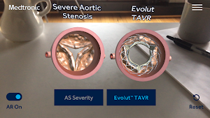 AS TAVR Education Screenshot 2