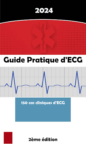 Guide d’ECG Screenshot 1