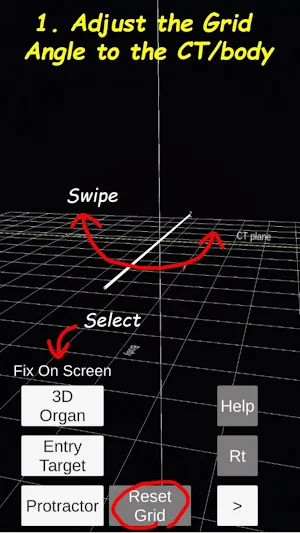 AR Puncture: Medical AR Viewer Screenshot 0