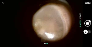 hearScope Screenshot 2