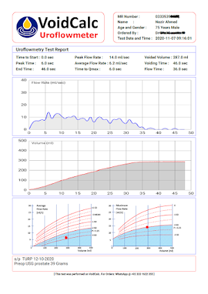 VoidCalc Screenshot 1