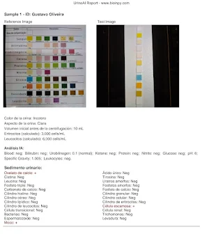 Urine AI Strip reader Screenshot 1