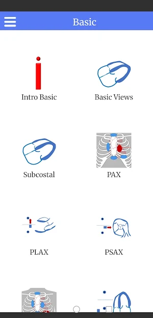EM Demo: Echo Basics Screenshot 3