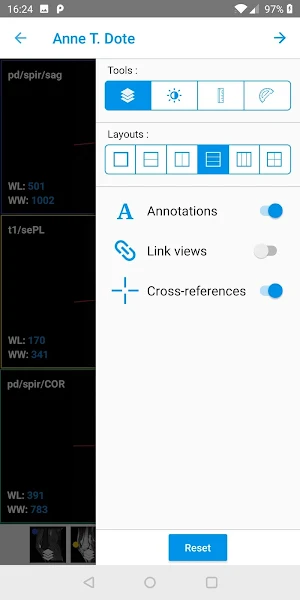 IMAIOS Dicom Viewer Screenshot 2