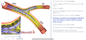 Bifurcaid 3D Screenshot 3