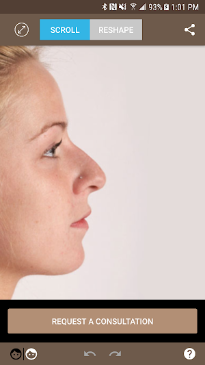 Rhinoplasty with Dr. Portuese Screenshot 3