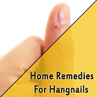 Home Remedies For Hangnails