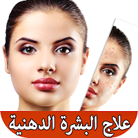 خلطات للبشرة الدهنية