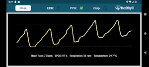 HealthyPi Screenshot 2