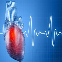 Expert system: MI heart attack