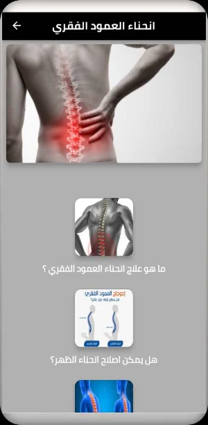 انحناء العمود الفقري Screenshot 1