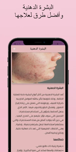 البشرة الدهنية وطرق لعلاجها Screenshot 2