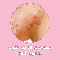 Recipes for removing acne