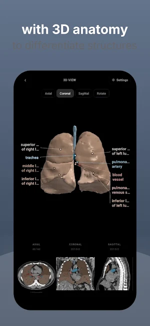 RadioAnatomy Screenshot 2