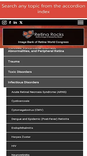 Retina Rocks Screenshot 3